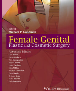 Female Genital Plastic and Cosmetic Surgery 1st Edition