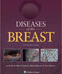 Diseases of the Breast 5e Fifth Edition