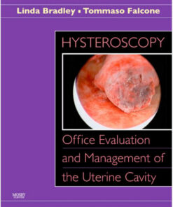 Hysteroscopy: Office Evaluation and Management of the Uterine Cavity: Text  1e