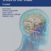 Neurosurgery Tricks of the Trade - Cranial 1st edition Edition