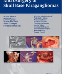 Microsurgery of Skull Base Paragangliomas 1st edition