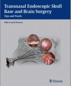 Transnasal Endoscopic Skull Base and Brain Surgery: Tips and Pearls 1st edition