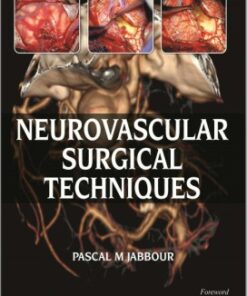 Neurovascular Surgical Techniques