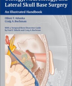 Otology, Neurotology, and Lateral Skull Base Surgery: An Illustrated Handbook 1st edition