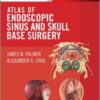 Atlas of Endoscopic Sinus and Skull Base Surgery