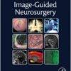 Image-Guided Neurosurgery 1st Edition