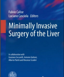 Minimally Invasive Surgery of the Liver