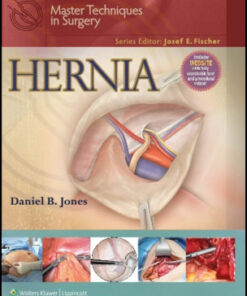 Master Techniques in Surgery: Hernia