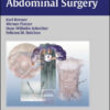 Minimally Invasive Abdominal Surgery