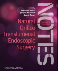 Natural Orifice Translumenal Endoscopic Surgery: Textbook and Video Atlas