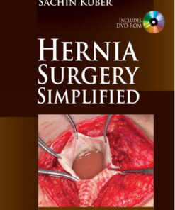 Hernia Surgery Simplified