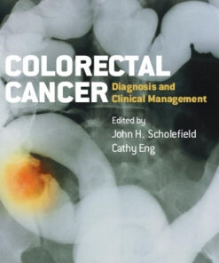 Colorectal Cancer: Diagnosis and Clinical Management