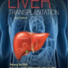 Living Donor Liver Transplantation 2nd Edition