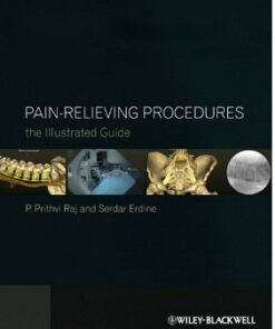 Pain-Relieving Procedures: The Illustrated Guide