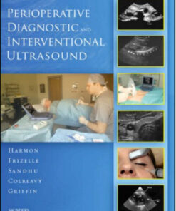 Perioperative Diagnostic and Interventional Ultrasound