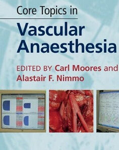 Core Topics in Vascular Anaesthesia