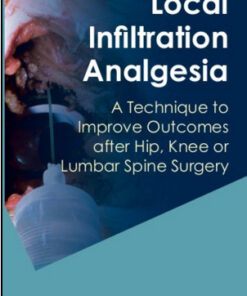 Local Infiltration Analgesia: A Technique to Improve Outcomes after Hip, Knee or Lumbar Spine Surgery