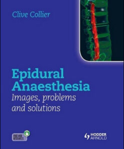 Epidural Anaesthesia: Images, Problems and Solutions