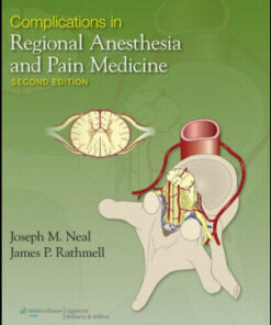 Complications in Regional Anesthesia and Pain Medicine, 2nd Edition