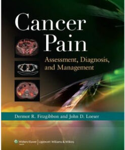 Cancer Pain: Assessment, Diagnosis, and Management