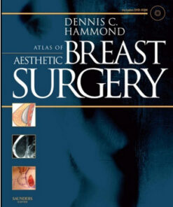 Atlas of Aesthetic Breast Surgery