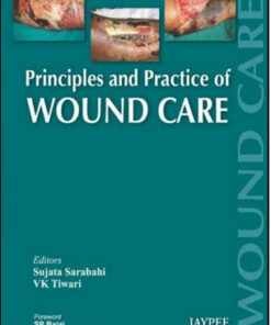 Principles and Practice of Wound Care