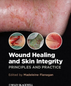 Wound Healing and Skin Integrity: Principles and Practice