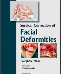 Surgical Correction of Facial Deformities