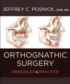 Orthognathic Surgery: Principles and Practice – 2 Volume Set