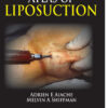 Atlas of Liposuction