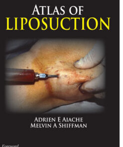 Atlas of Liposuction