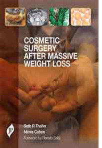 Cosmetic Surgery After Massive Weight Loss