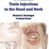 Techniques of Botulinum Toxin Injections in the Head and Neck