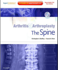 Arthritis and Arthroplasty: The Spine: 1e Edition