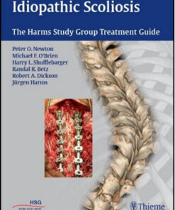 Idiopathic Scoliosis: The Harms Study Group Treatment Guide