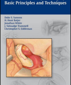 Intracranial Aneurysm Surgery: Basic Principles and Techniques