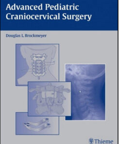 Advanced Pediatric Craniocervical Surgery