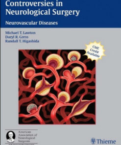 Controversies in Neurological Surgery: Neurovascular Diseases