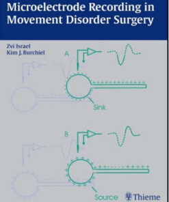 Microelectrode Recording in Movement Disorder Surgery 1st Edition