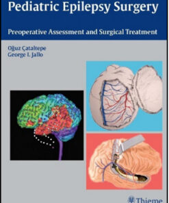 Pediatric Epilepsy Surgery: Preoperative Assessment and Surgical Treatment