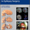 Operative Techniques in Epilepsy Surgery