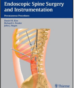 Endoscopic Spine Surgery and Instrumentation: Percutaneous Procedures