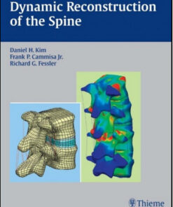 Dynamic Reconstruction of the Spine