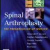 Spinal Arthroplasty : The Preservation of Motion