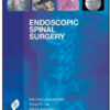 Endoscopic Spinal Surgery