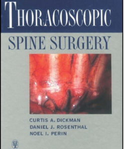 Thoracoscopic Spine Surgery