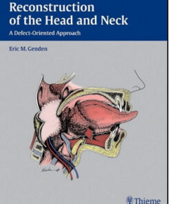 Reconstruction of the Head and Neck: A Defect-Oriented Approach