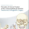 Principles of Internal Fixation of the Craniomaxillofacial Skeleton: Trauma and Orthognathic Surgery