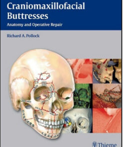 Craniomaxillofacial Buttresses: Anatomy and Operative Repair