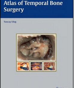 Atlas of Temporal Bone Surgery